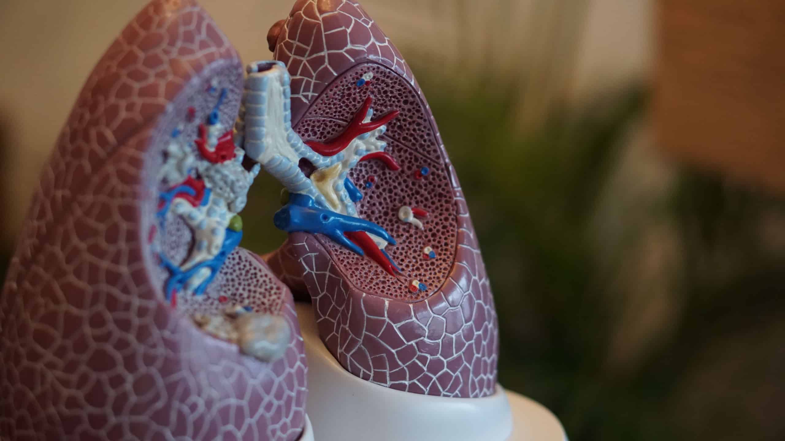 COPD, lung cancer