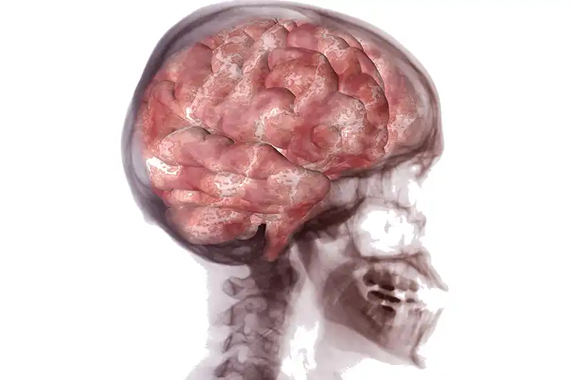 illustration of the human brain superimposed