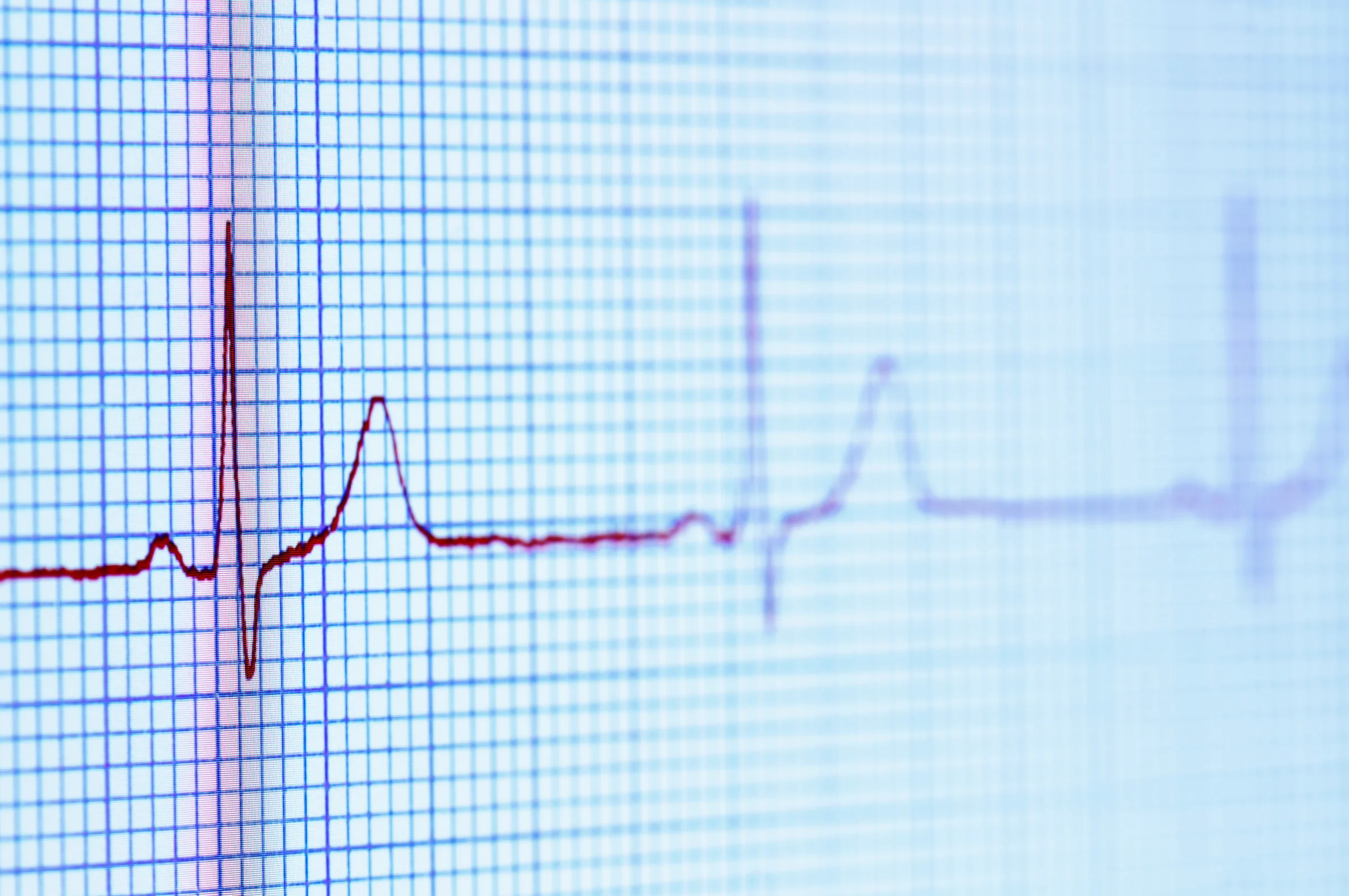 Heartburn or Heart Attack? How to Tell the Difference
